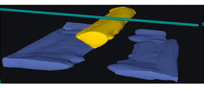 Figure 6c GPR tendon duct